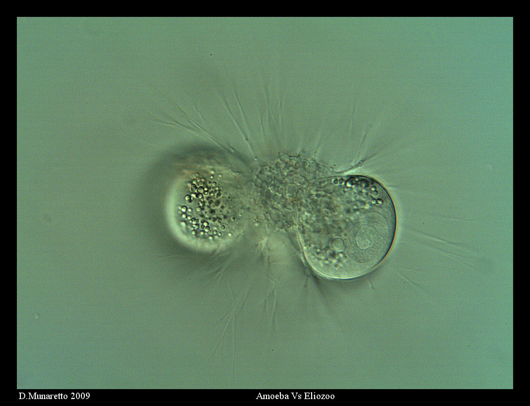 Amoebe VS ELiozoo